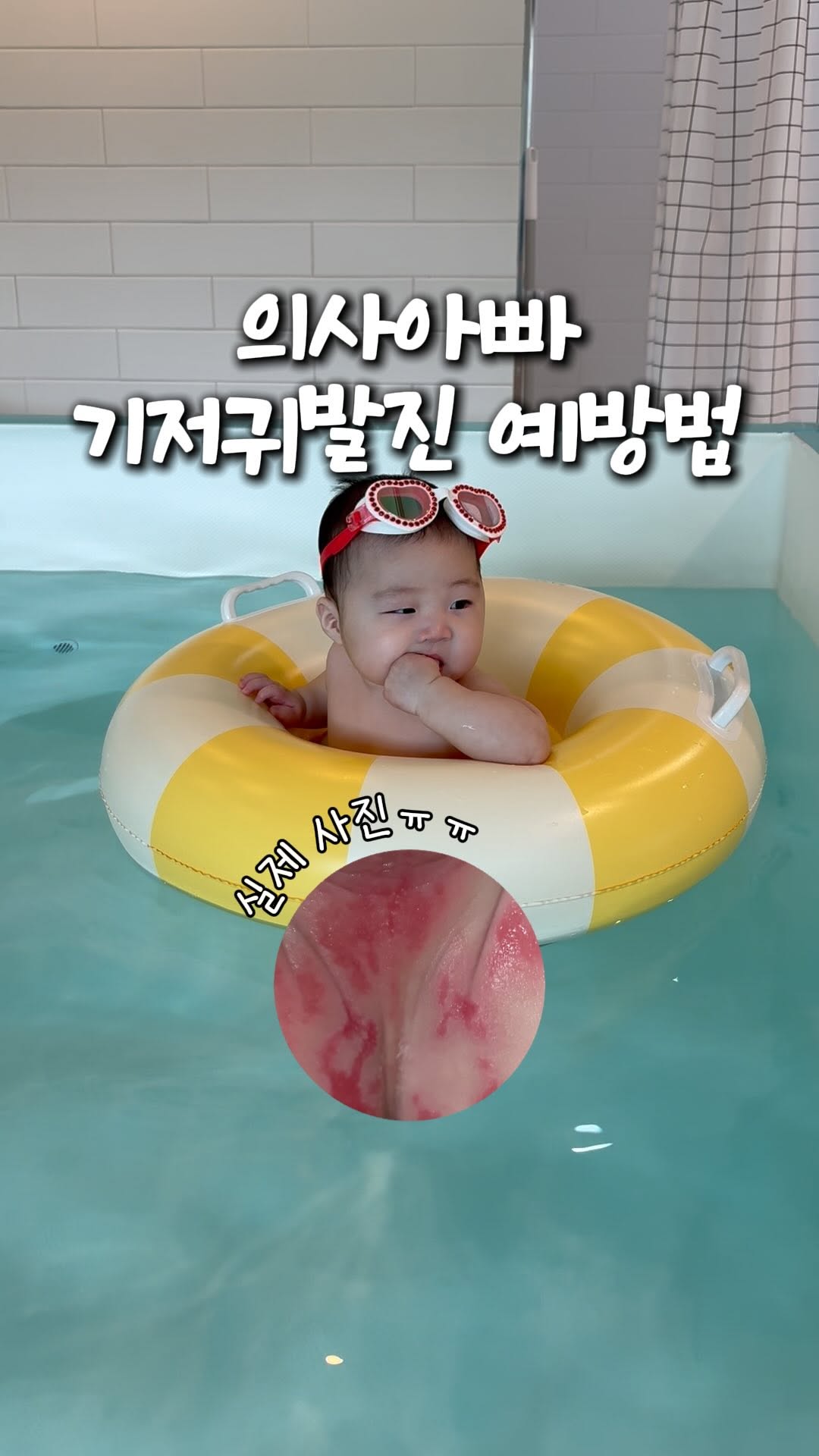 징크 옥사이드 크림