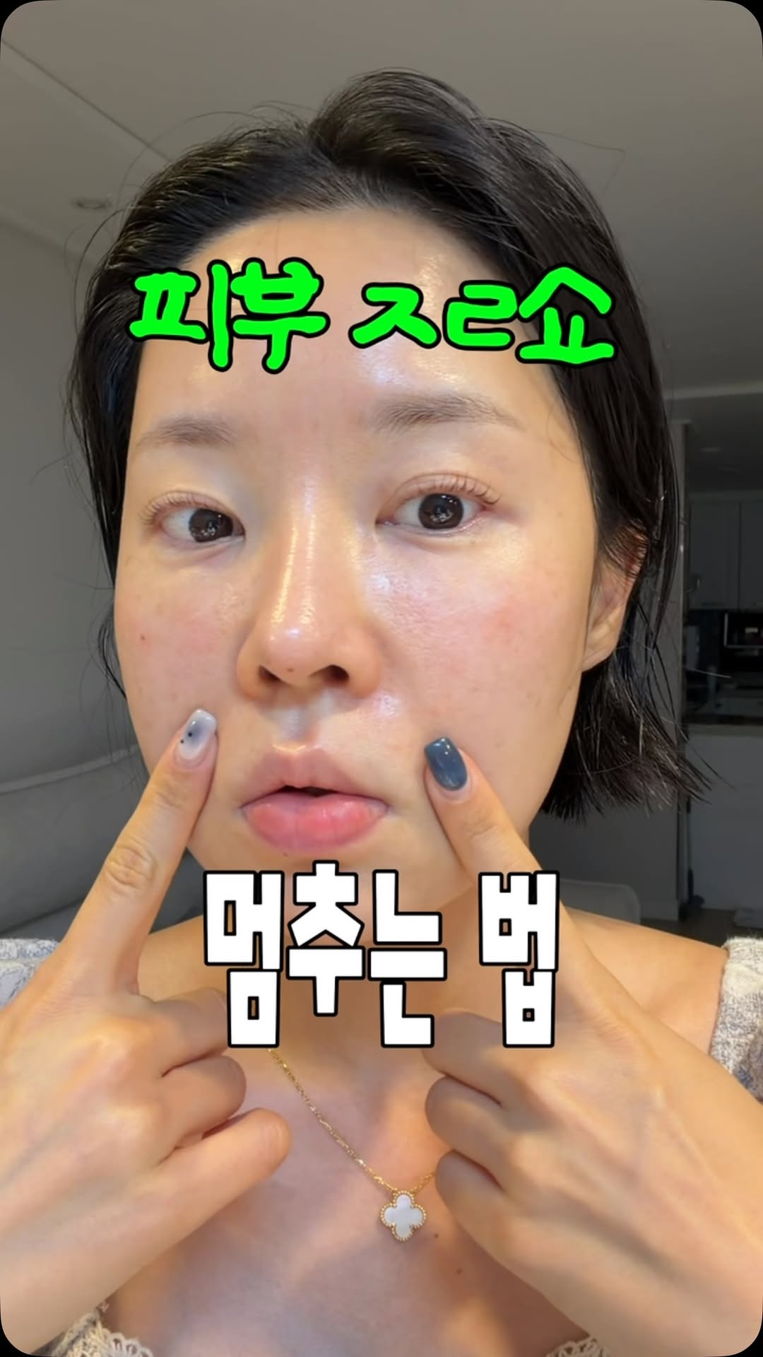 시카겔