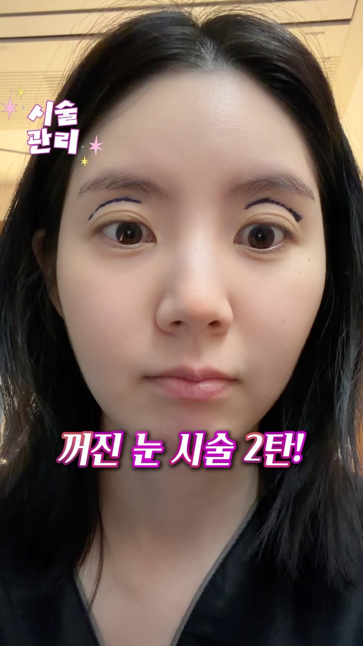 아이케어 디바이스