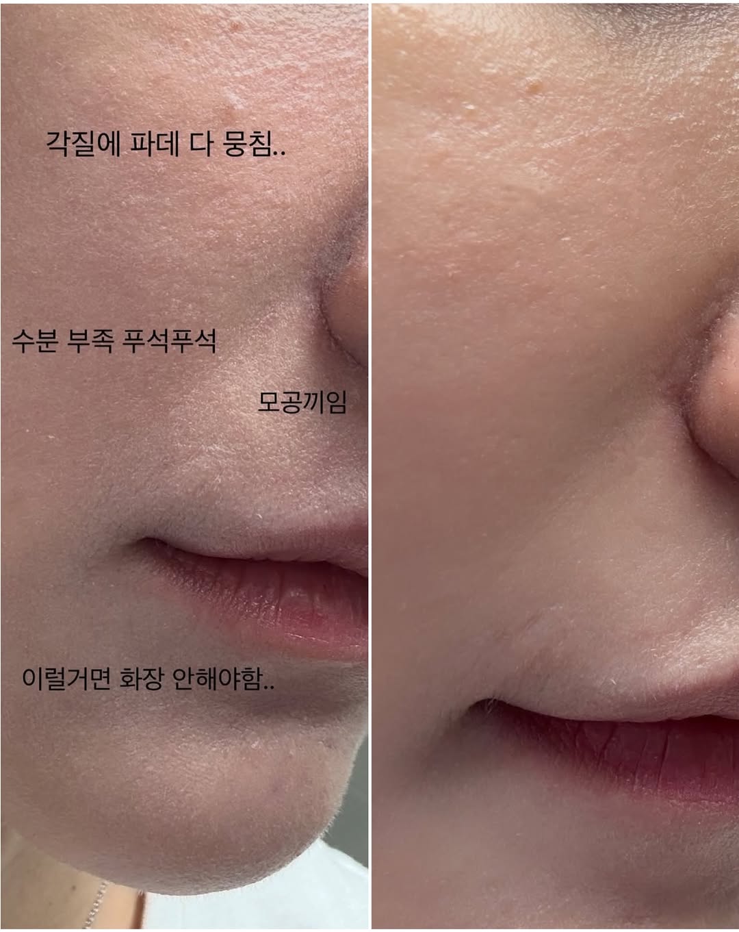 인앤아웃 마스크팩