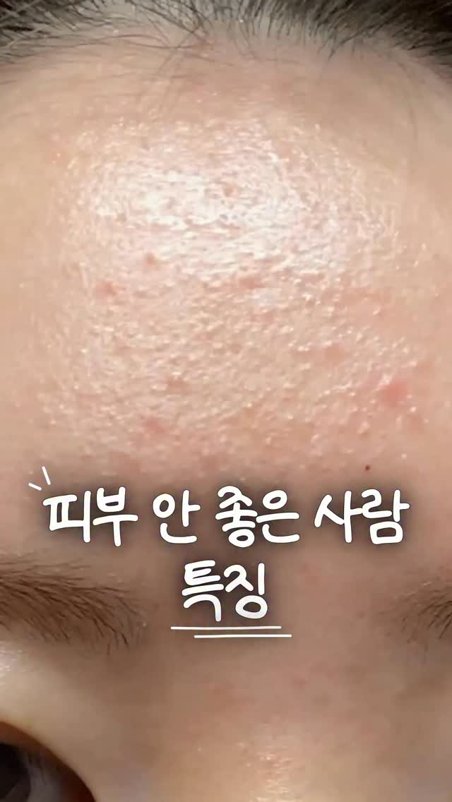 콜라겐
