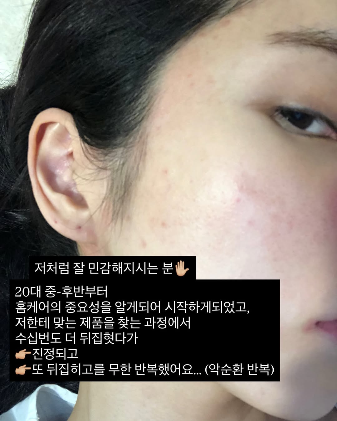 부활기초라인 & 콜라겐크림