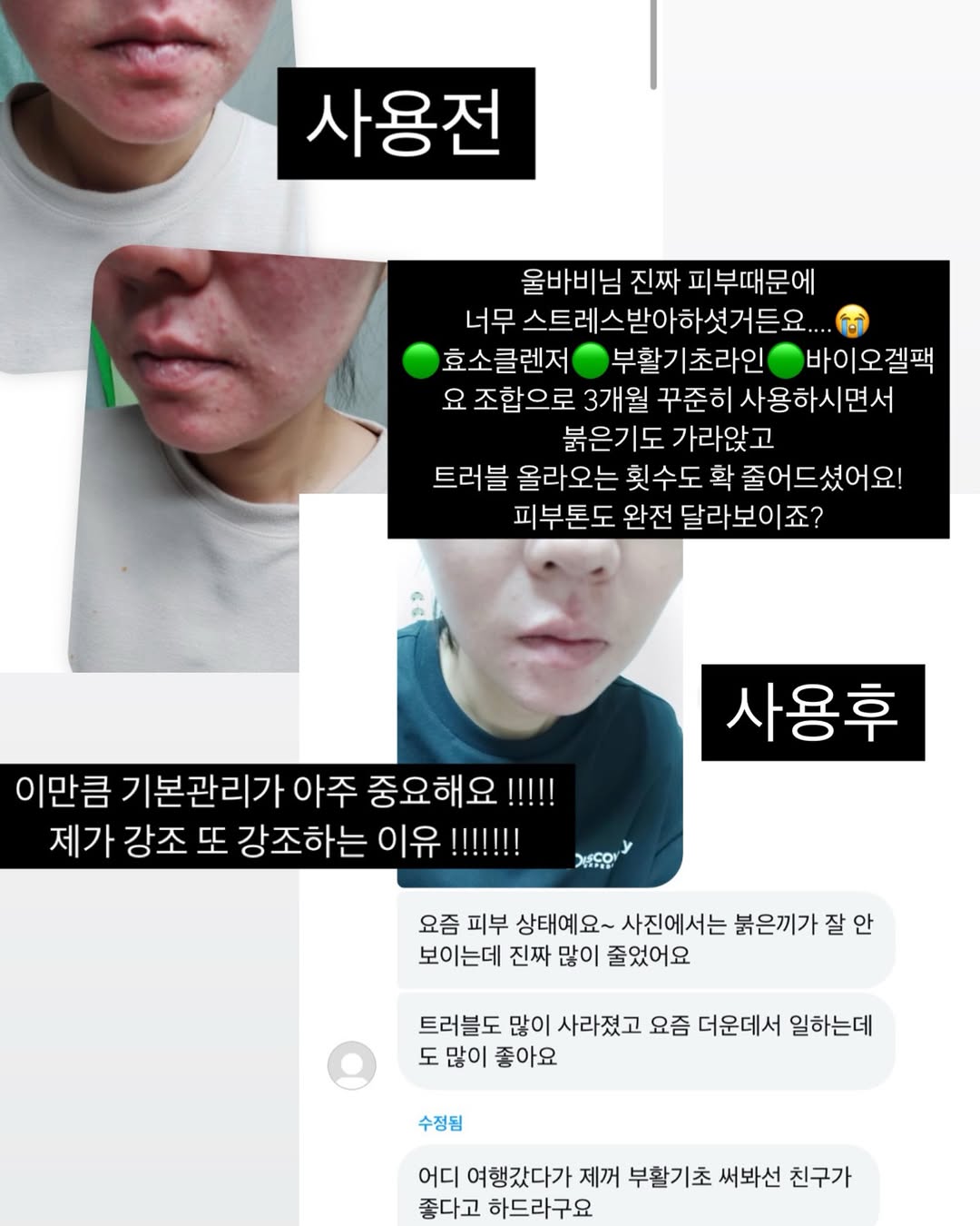 부활기초라인 & 콜라겐크림