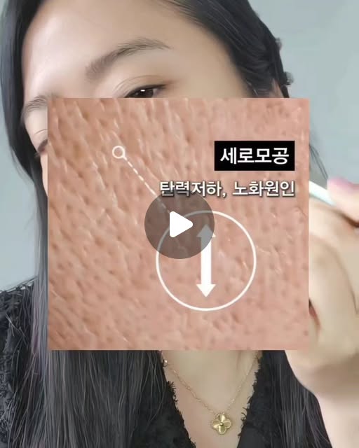 모공크림